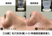 ポア ラボ(Pore Lab)