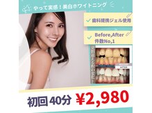 ホワイトニングショップ 宇都宮店