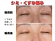ブーケの写真/【シミ・くすみが気になる肌に】紫外線ダメージが大きくなる今こそ本気の美白ケア始めましょう！