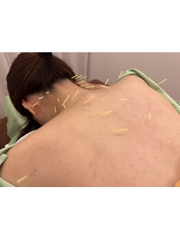 首・肩のつらさを改善したい