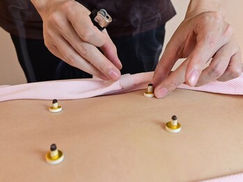 ヨウジョウ サロン ウェル 鴨池院(YOUJOU salon WELL)/夏でもクーラー冷え性増えてます