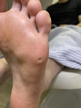 痛み無くなった!