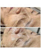 エース(ACE.)/くすみ改善！化粧ノUP☆