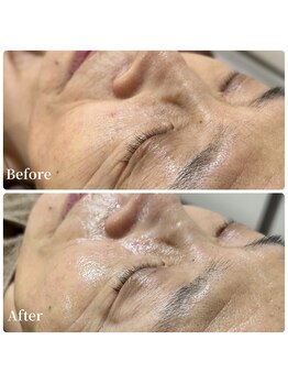 エース(ACE.)/くすみ改善!化粧ノUP☆