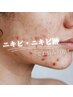 悩むあなたにスペシャルケア【毛穴洗浄＋再生修復ハーブピーリング】20,000→