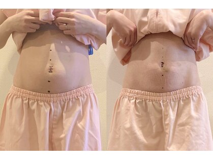 アカシア鍼灸整骨院の写真