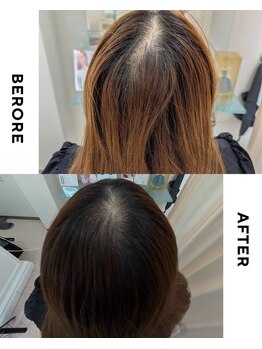 パーフェクトアイ(Perfect EYE)/【TOKIKATA】頭皮の汚れを落とし