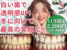 LBSホワイトニング 新宿店