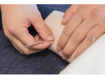 トキハナ アンド アマト(AMATO)/◆施術風景(てい鍼)