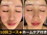 【本気の肌質改善×10回】セルマン艶肌ピーリング＋デコルテ※ホームケア付き