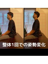 伝統鍼灸喜心堂/整体beforeafter