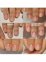 ニコプラス(NICO+)/自爪育成中