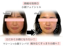 エビアス(Evias)の雰囲気（マシーン×マッサージのW施術で感動の小顔へ♪施術3回）