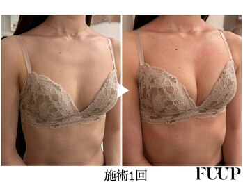 フーアップ 北千住(FU-UP)/バストアップ/育乳（1回）