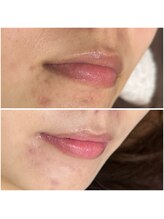 ミイン(美in)/ローマピンク