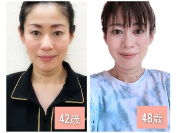 そら/小顔/神経整体