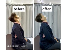 由利本荘整体院/施術ビフォーアフター（首）