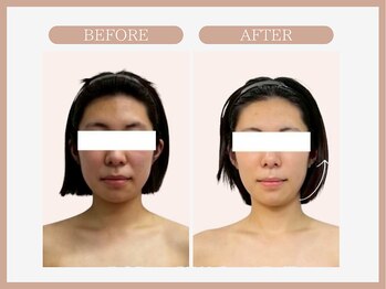 スリムライン 八戸店(The Slim Line)/before→after