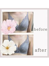 アリサナ(Arisana)/症例写真　バスト　葛西