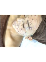 レア(le'a)/ハイドロジェリーパック