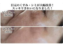 リザ(Rize)の雰囲気（Wiqo×エンビロン導入コース。一回でも実感。シミ改善、艶ハリ◎）