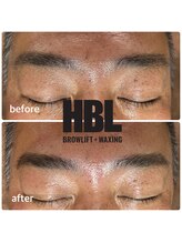 フェリス(FELIZ)/ハリウッドブロウリフト