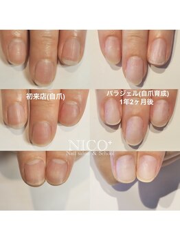 ニコプラス(NICO+)/自爪育成中