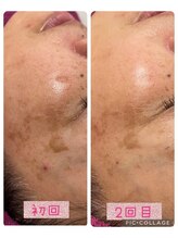 ビューティーサロン キャンディ 海老名(Candy)/