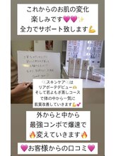 ミミルーチェ(mimiluce)/お客様の口コミ