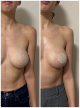 ルナグランデ 心斎橋店(Luna grande.)/だんだん効果を実感　