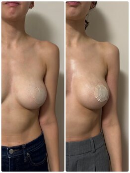 ルナグランデ 心斎橋店(Luna grande.)/だんだん効果を実感　