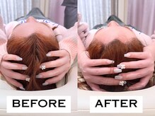 ビハリスト 新宿南口/頭のサイズからしっかり小顔に♪