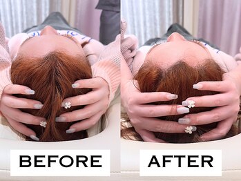 ビハリスト 新宿南口/頭のサイズからしっかり小顔に♪