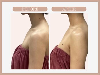 スリムライン 八戸店(The Slim Line)/before→after