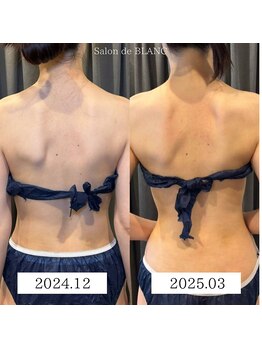 サロン ド ブラン アオヤマ(Salon de BLANC AOYAMA)/