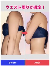 カルミア 心斎橋店/ゼロコース/30代のお客様