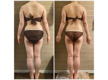 エムズ ビューティー サロン(M's Beauty Salon)/ビフォーアフター