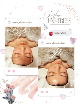 ハレル(Hareru)/Before…After(13)　UNSTRESS