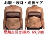【お腹】 妊娠線・お腹のたるみケア｜燃焼＆引き締めマシン ¥23200→￥9900