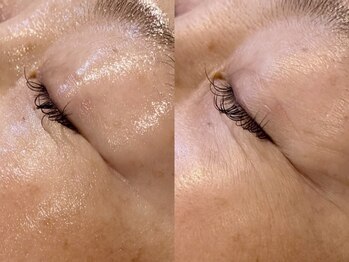 サロンドボーテ オランジュ(salon de beaute Orange)の写真/【年齢を重ねても、素肌はもっと美しく】
リアボーテで始める、これからの肌づくり◎
