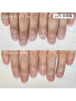 ホワイトネイル 武蔵小杉店(WHITE NAIL)/【自爪育成】