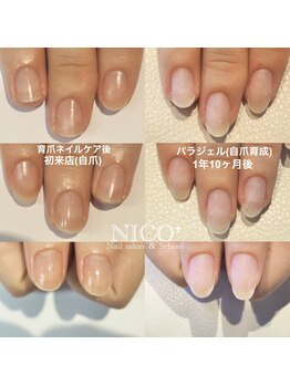 ニコプラス(NICO+)/自爪育成中
