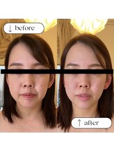 トータルビューティーサロンリア(Li'a)/ビフォー＆アフター