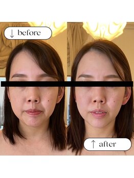トータルビューティーサロンリア(Li'a)/ビフォー＆アフター