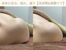 エミルカ 仙台(EMILUCA)の雰囲気（PC.スマホ.腕の使いすぎや目の疲れ→根本凝りケア＆姿勢改善◎）