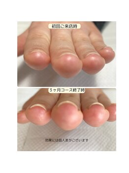 ルームイチマルイチネイルズ(Room101Nails.)/自爪育成・最強のネイルケア鳥取
