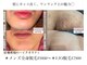 ヴェヌスタ サカイ(VENUSTA SAKAI)の写真