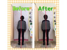 すこやか整骨院 陽南店/ビフォーアフター