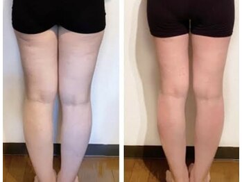 ファミリーセルフサロン 輪(Wa)/話題のセルクラ