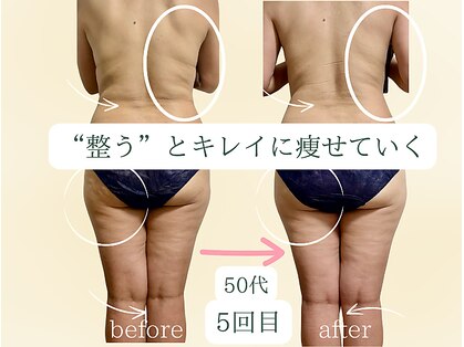 ヨサパーク リボーン(YOSA PARK Reborn)の写真
